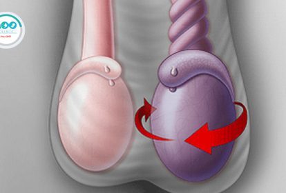 xoắn tinh hoàn - bệnh lý nguy hiểm khi trời lạnh