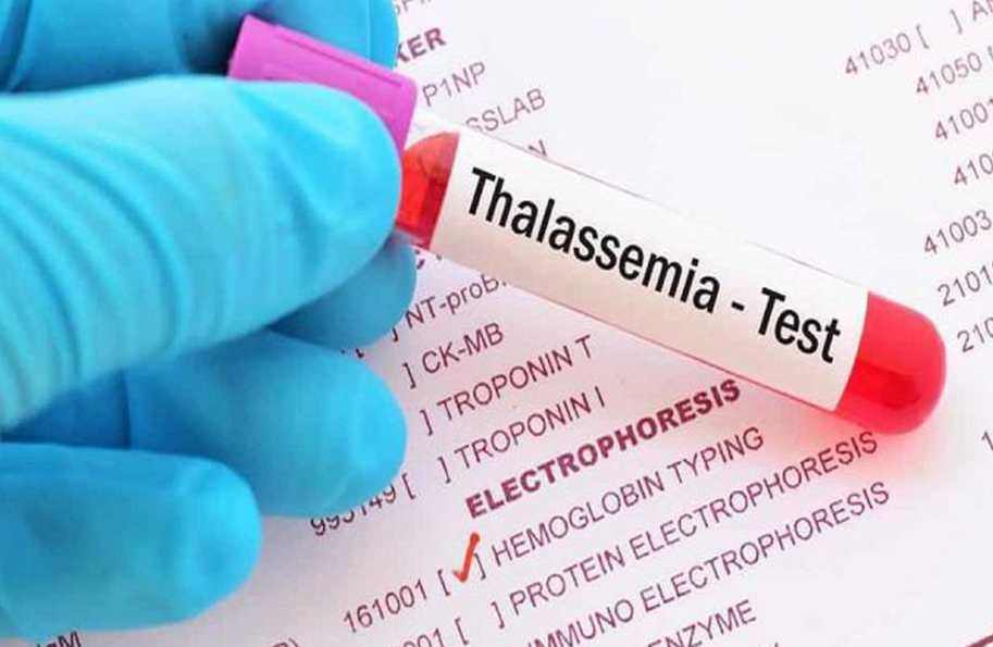 Thalassemia là một bệnh lý nguy hiểm, ảnh hưởng rất lớn đến chất lượng cuộc sống của trẻ