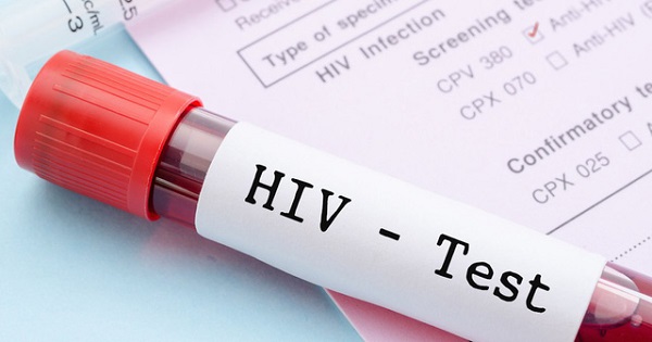 Xét nghiệm phơi nhiễm HIV AB Test có chính xác không?