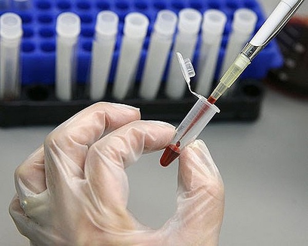 Xét nghiệm HIV AB Test nhanh 