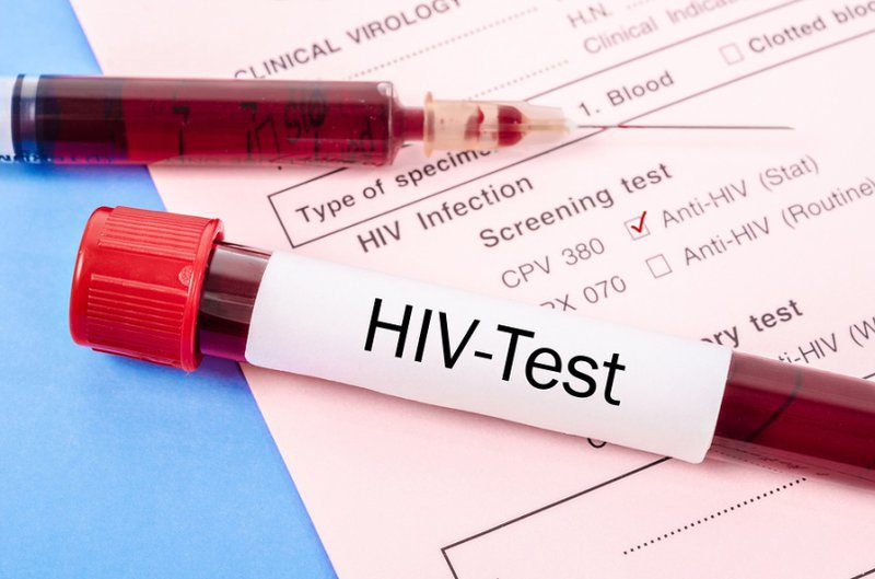 Thời điểm xét nghiệm HIV cho kết quả chính xác nhất là sau khi phơi nhiễm với virus từ 2 - 3 tháng