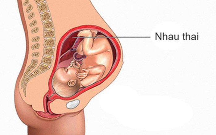Phụ nữ sau khi phá thai bằng thuốc phải tái khám để chắc chắn lòng tử cung đã sạch thai hoàn toàn
