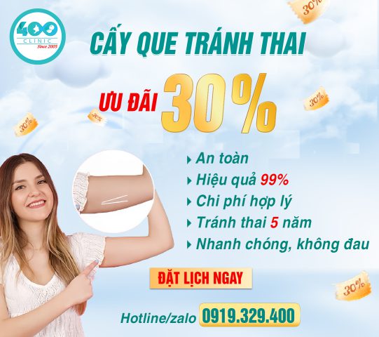 Cấy que tránh thai ưu đãi 30%