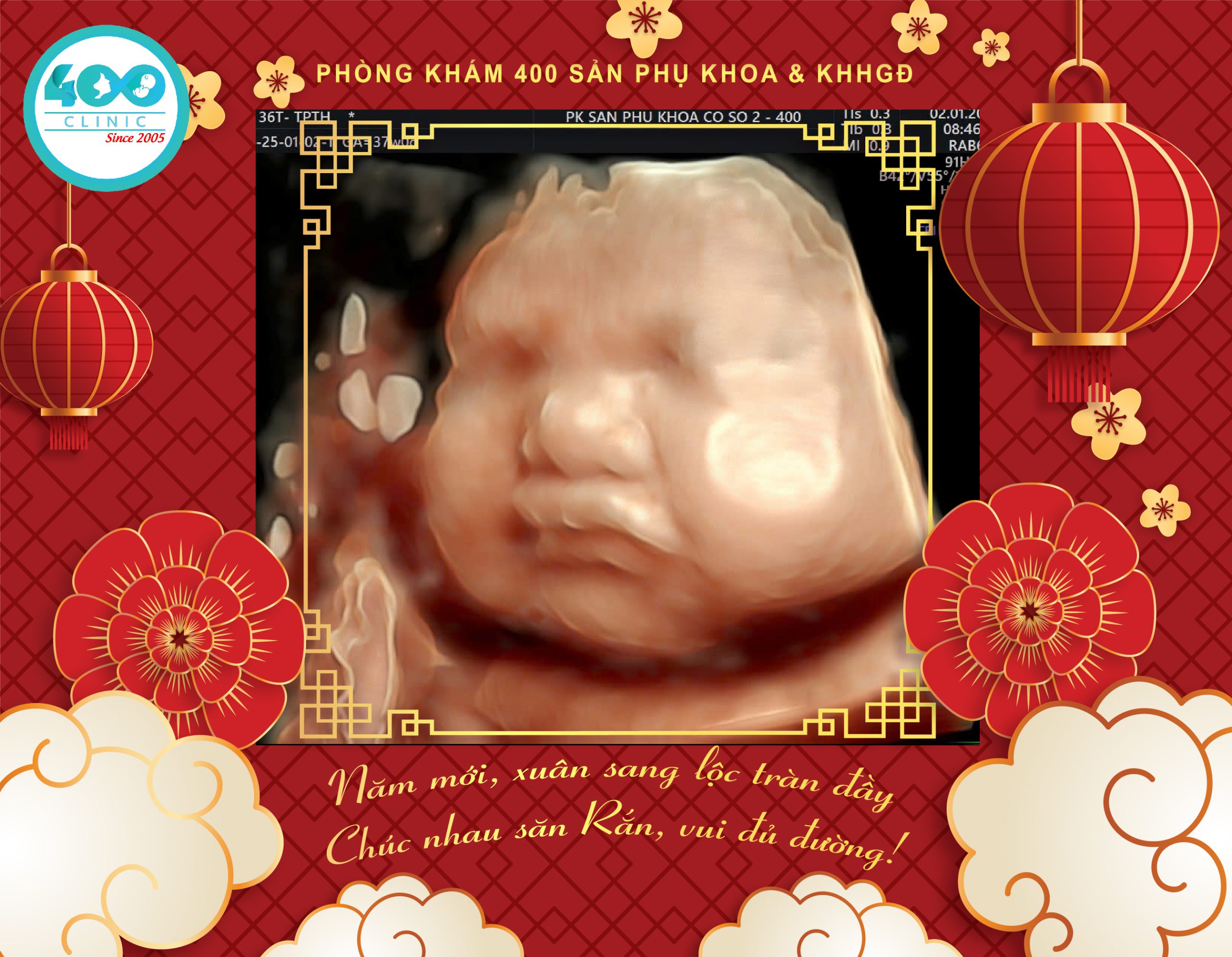 CHÚC MỪNG NĂM MỚI 2025
