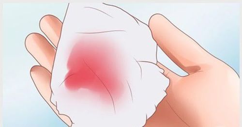 Nếu âm đạo khô kèm theo chảy máu âm đạo nghiêm trọng, hãy đến cơ sở y tế ngay lập tức