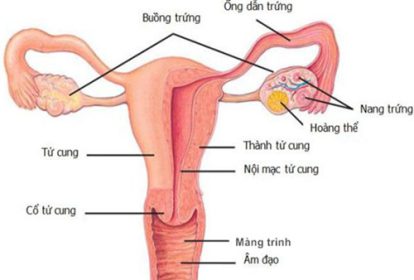Nang hoàng thể gây ảnh hưởng đến sức khỏe phụ nữ