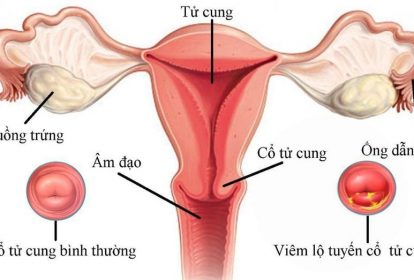 Cấu tạo tử cung