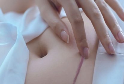 Sản phụ sinh mổ có thể mất một thời gian để hệ tiêu hóa bắt đầu trở lại hoạt động bình thường
