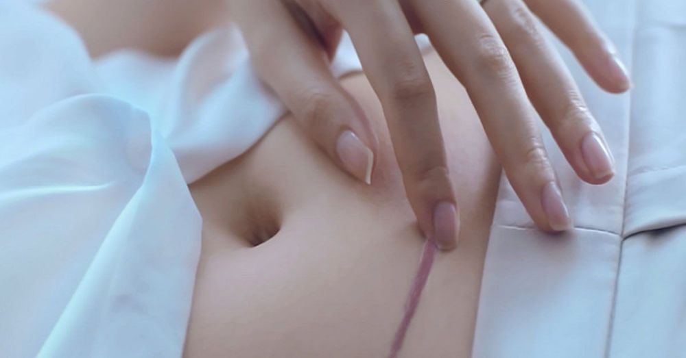 Sản phụ sinh mổ có thể mất một thời gian để hệ tiêu hóa bắt đầu trở lại hoạt động bình thường