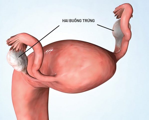 Hai buồng trứng trong cơ thể người phụ nữ