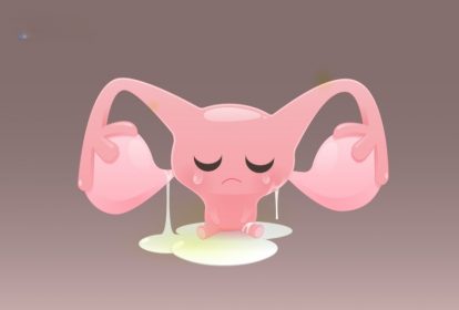 Khí hư bã đậu có mùi hôi có thể làm giảm khả năng sinh sản.